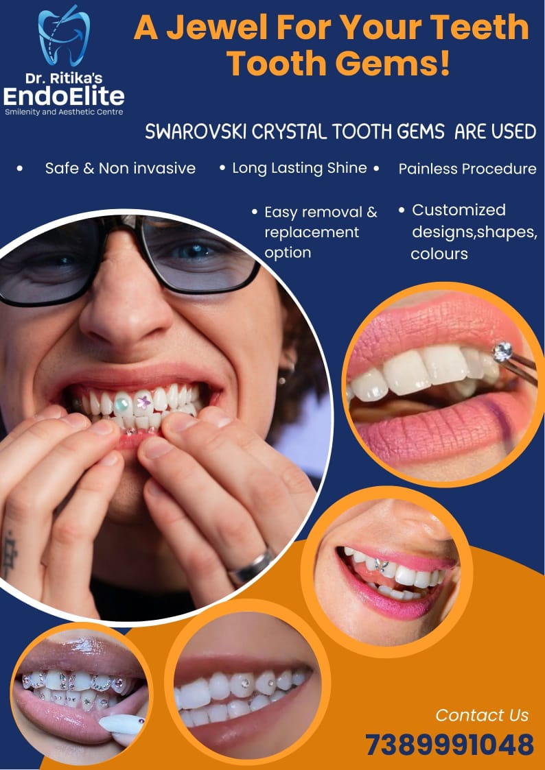 Root Canal Retreatment Procedure